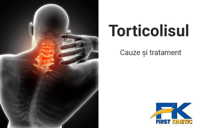Torticolisul – Cauze și tratament